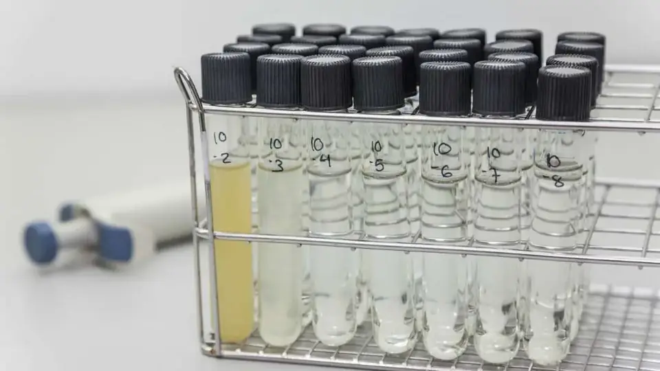 Gradilla con tubos de ensayo en un laboratorio